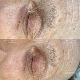 Крупный миллиум