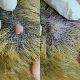 Лазерная деструкция невусов на волосистой части головы